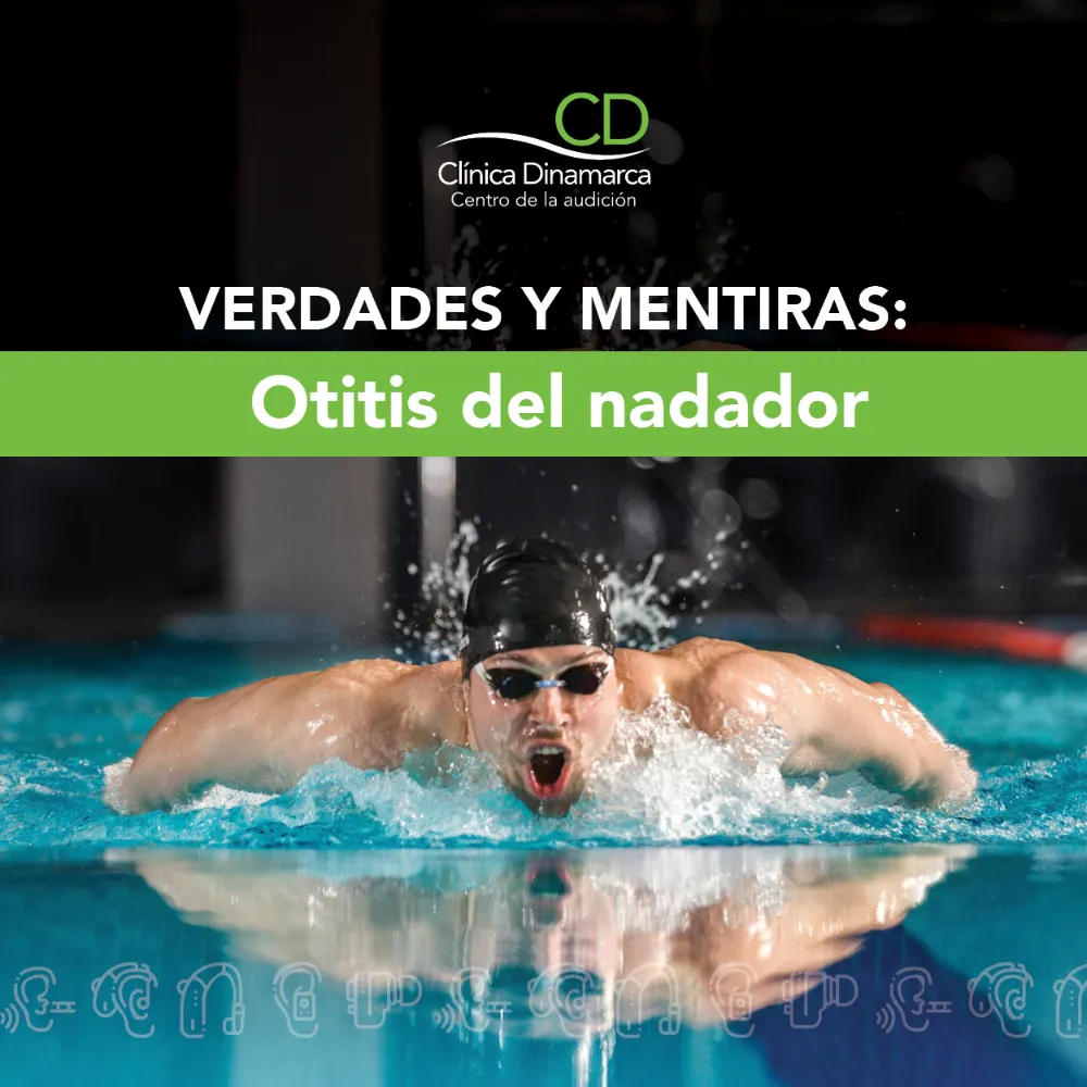 Verdades y mentiras: Otitis del nadador